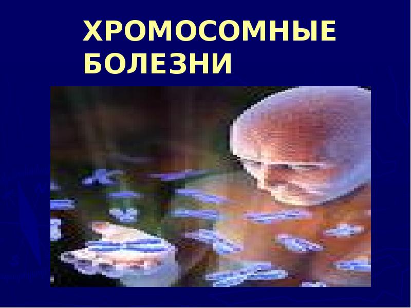 ХРОМОСОМНЫЕ БОЛЕЗНИ