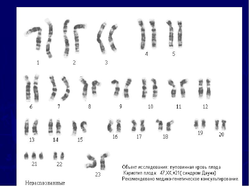 Хромосомные заболевания проект