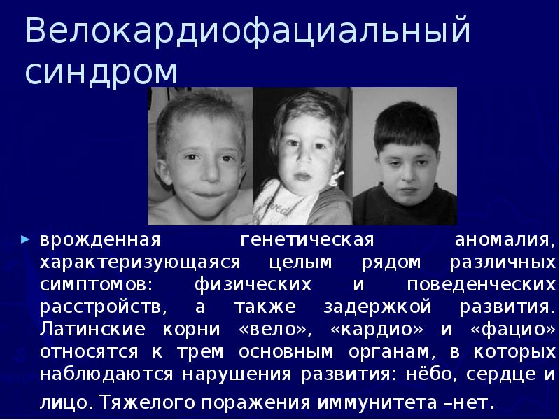 Велокардиофациальный синдром  врожденная генетическая аномалия, характеризующаяся целым рядом различных симптомов: