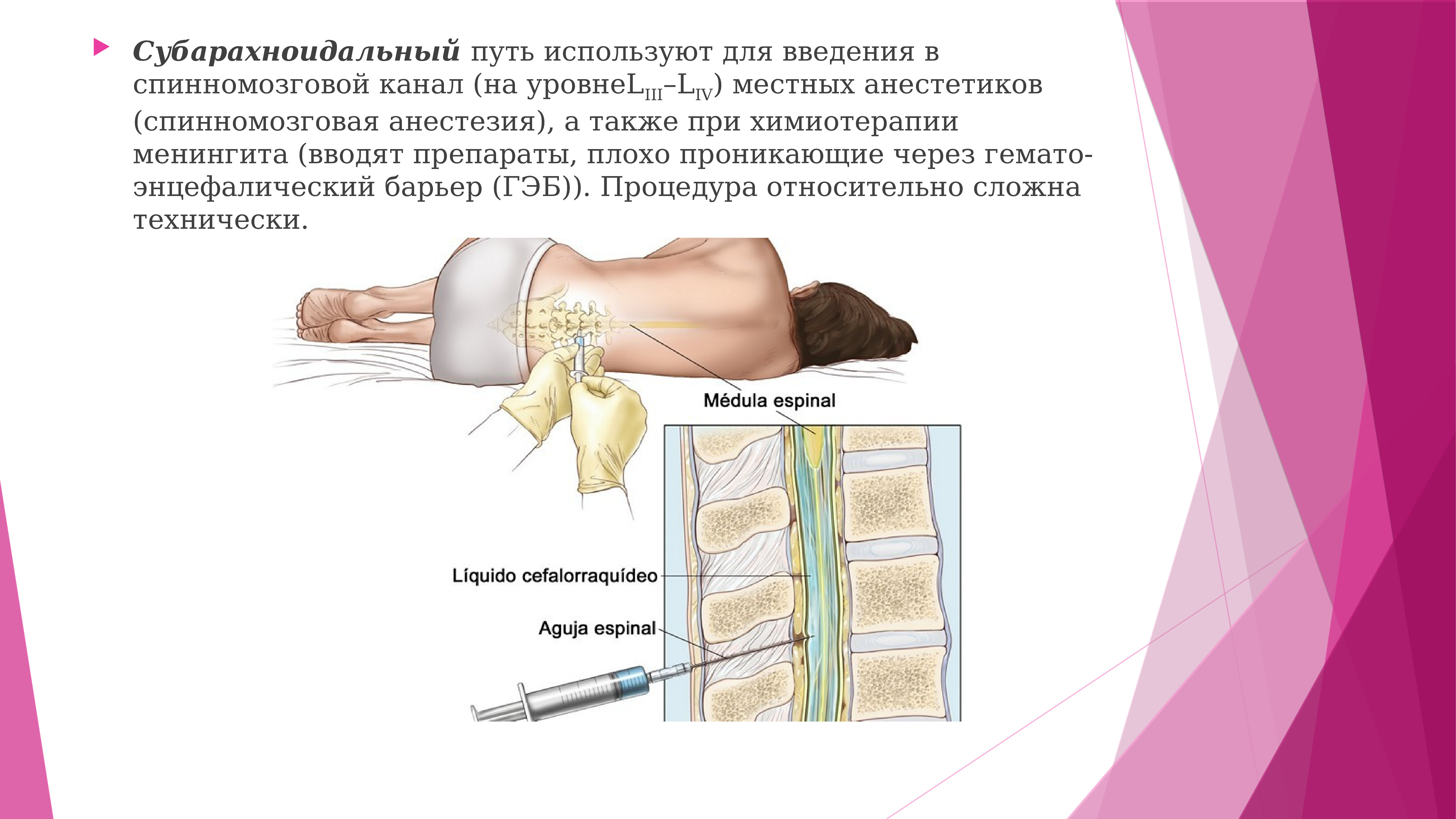 Спинномозговая анестезия презентация