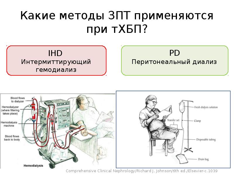 Методы заместительной почечной терапии. Гемодиализ картинки для презентации. Диализ картинки для презентации. Основы гемодиализа.