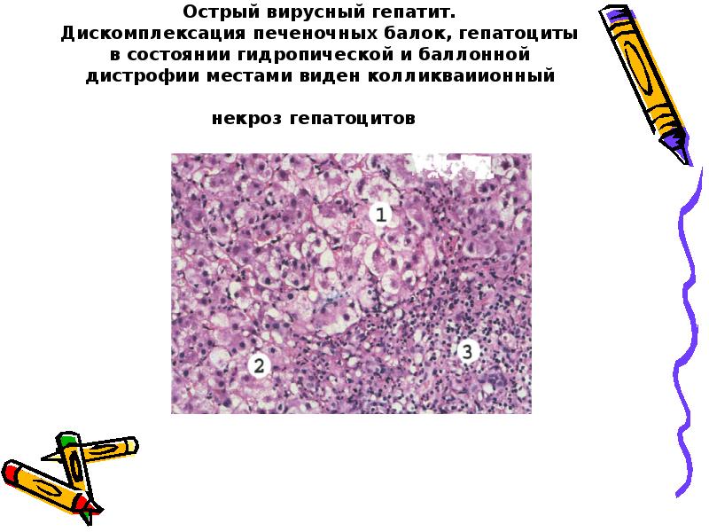 Подпишите виды дистрофий рисунки