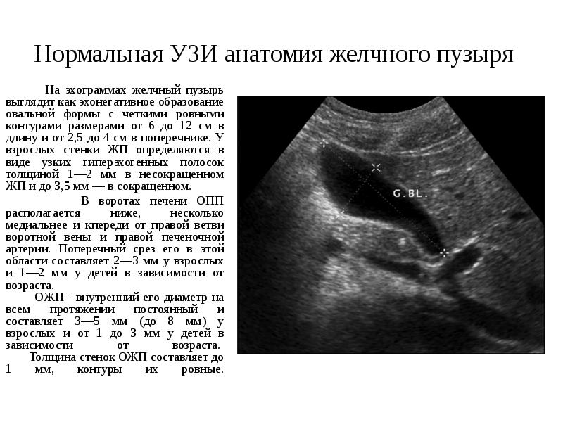 Характеристика эхонегативного изображения