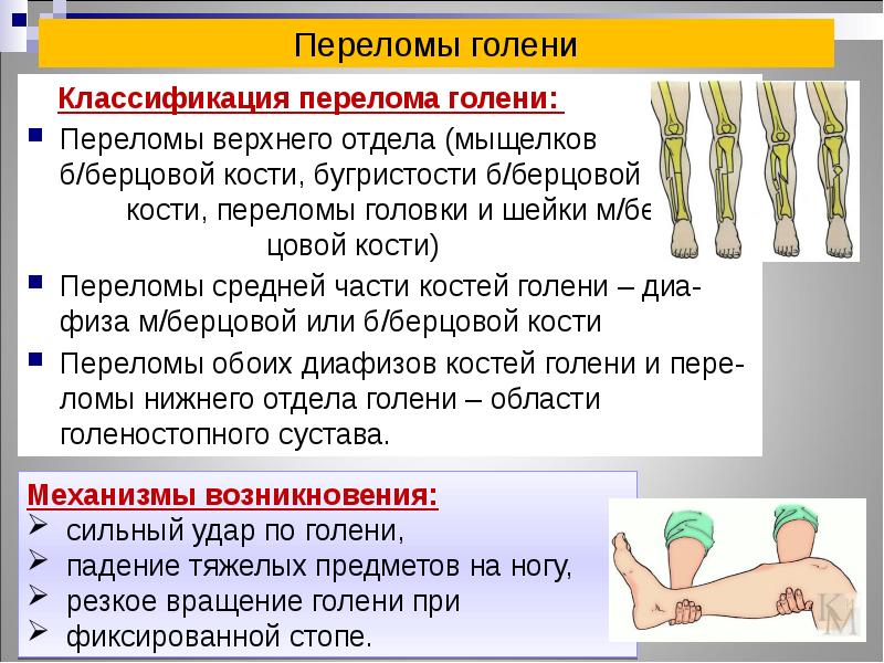 Диафизарные переломы костей голени презентация