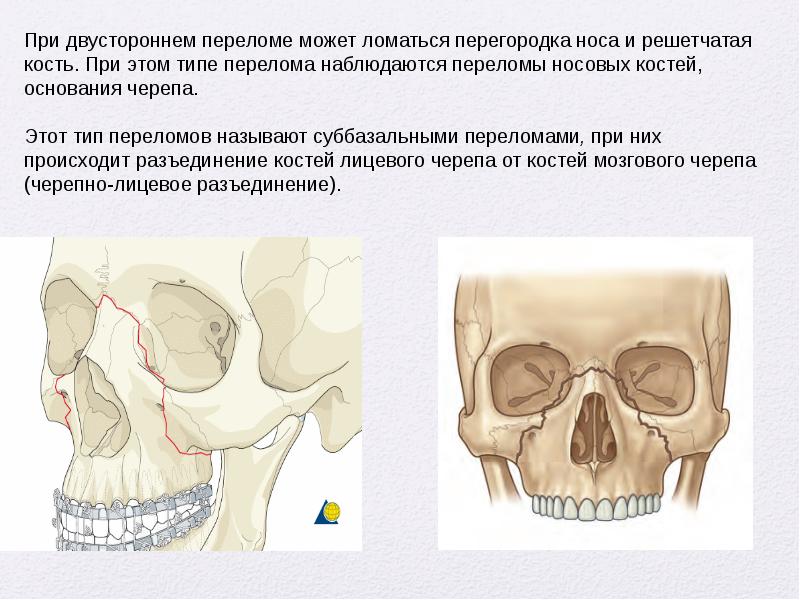 Восстановительная хирургия челюстно лицевой области презентация