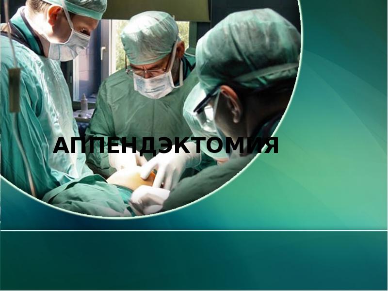 Аппендэктомия Аппендэктомия