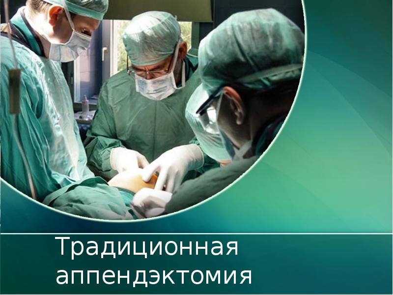 Традиционная аппендэктомия Традиционная аппендэктомия