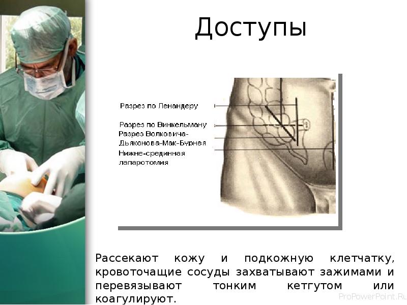 Доступы
Рассекают кожу и подкожную клетчатку, кровоточащие сосуды захватывают зажимами и Доступы
Рассекают кожу и подкожную клетчатку, кровоточащие сосуды захватывают зажимами и