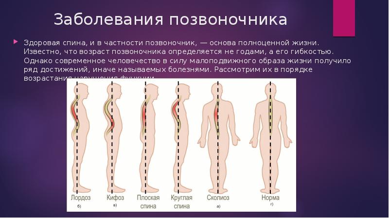 Нарушения позвоночника. Заболевания позвоночника. Возраст позвоночника. Здоровая спина.