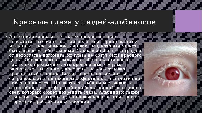 Заболевания органов зрения презентация