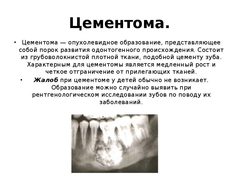 Презентация одонтогенные опухоли