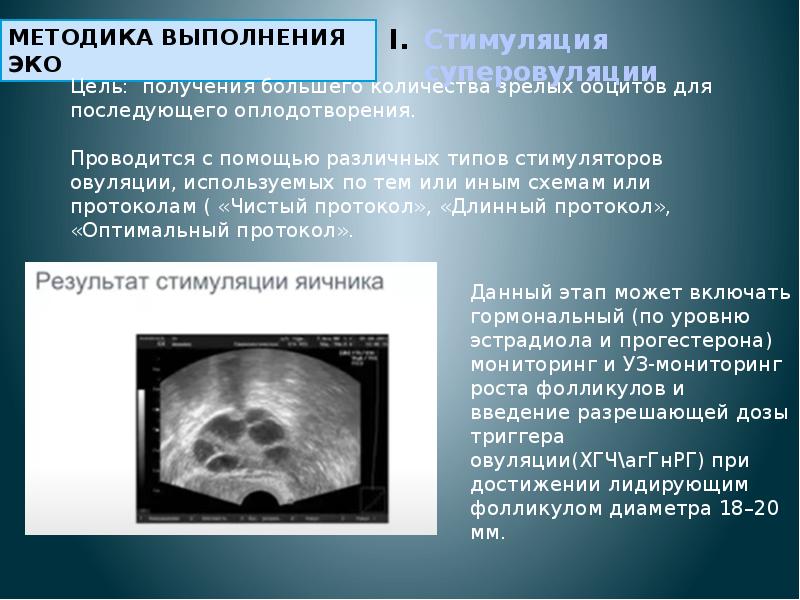 Экстракорпоральное оплодотворение презентация