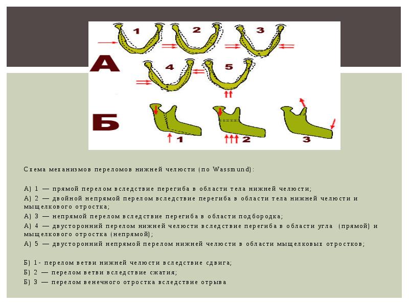 Клиническая картина при переломах нижней челюсти