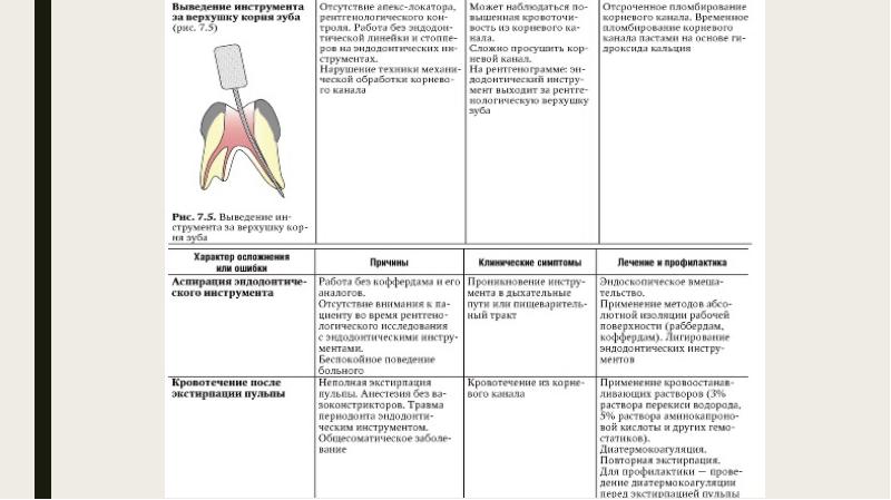 Ошибки и осложнения при лечении периодонтита презентация