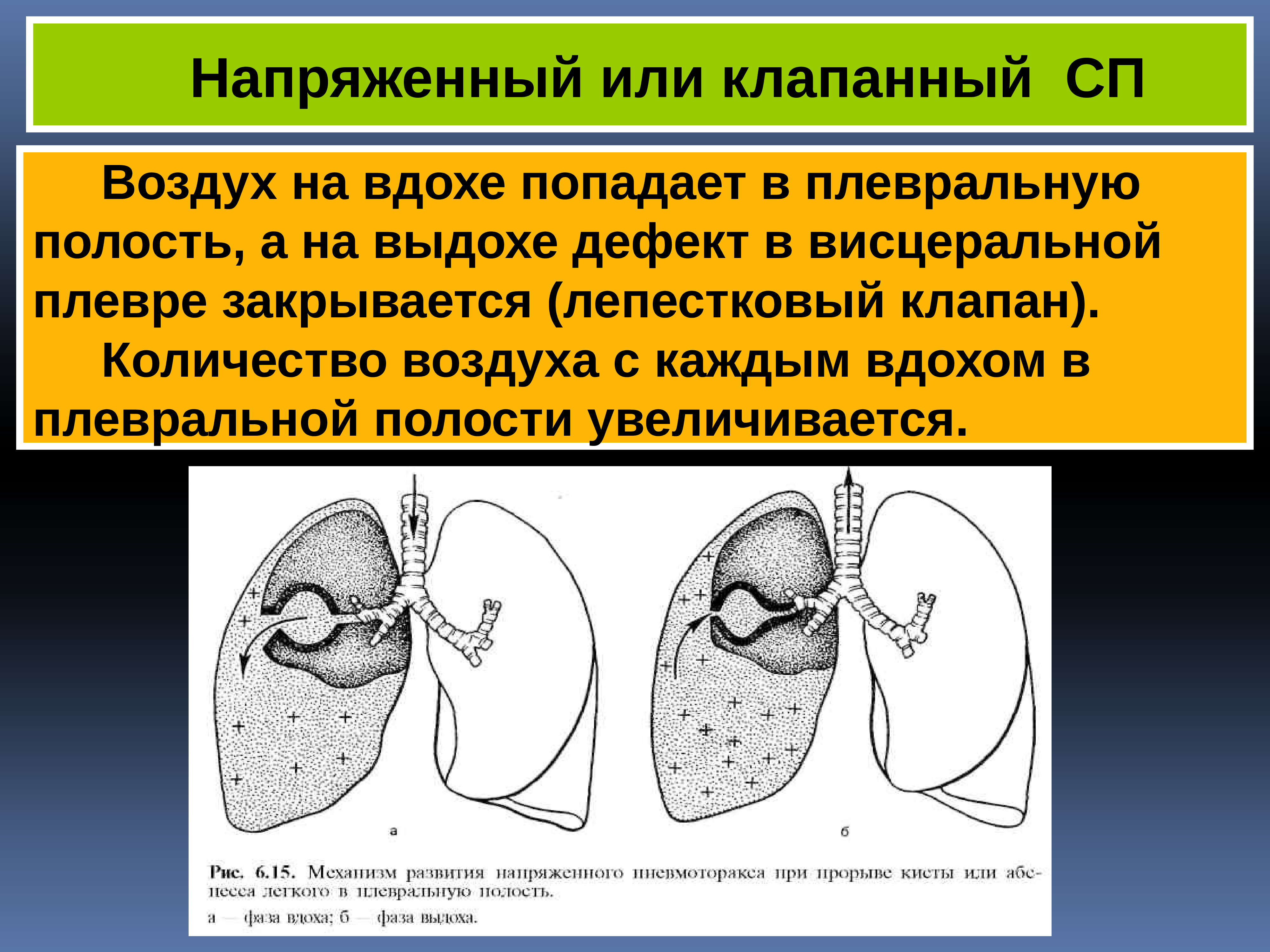 Пульмонология фтизиатрия. Плевральная полость при вдохе и выдохе. Фтизиатрия ва пульмонология. Плевральная полость вдох выдох.