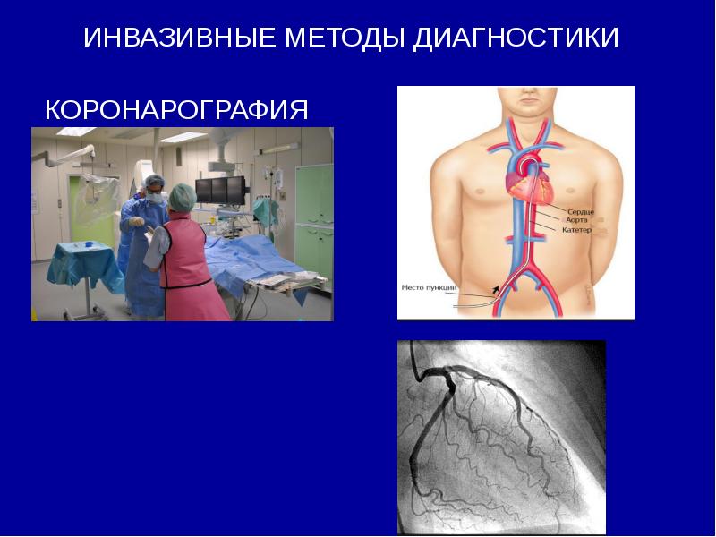 Лучевая диагностика сердечно сосудистой системы презентация