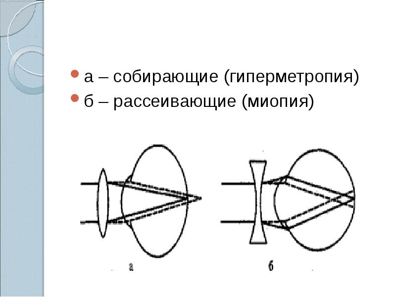 Рефракция глаза презентация