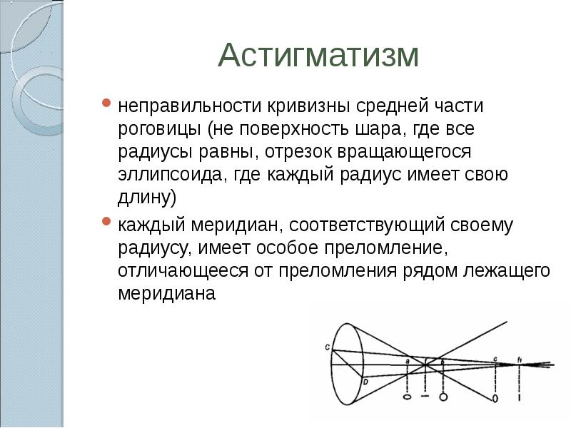 Рефракция глаза презентация