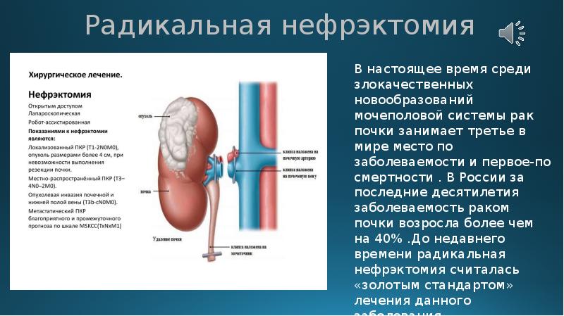 Нефроэктомия