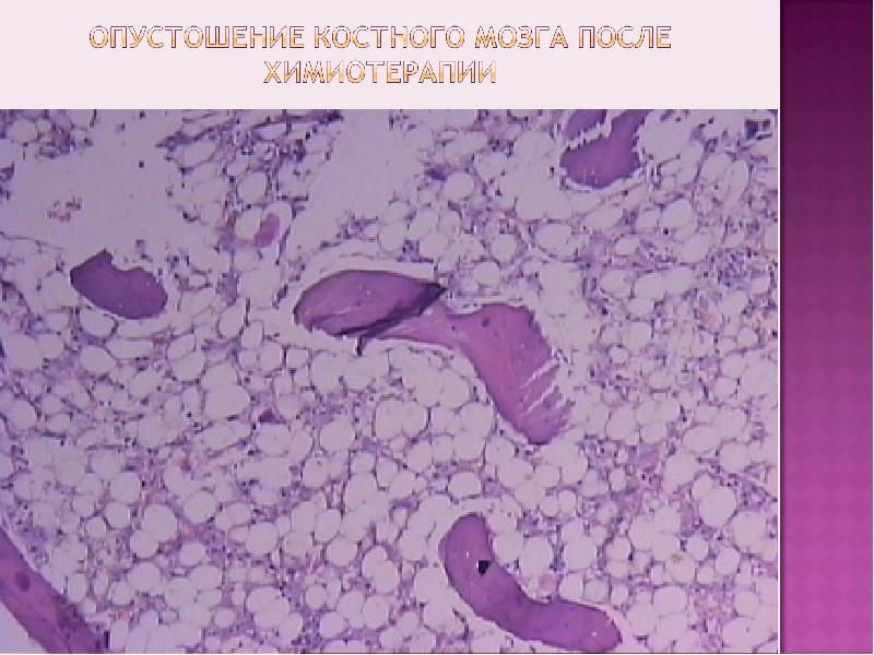 Болезни системы крови презентация