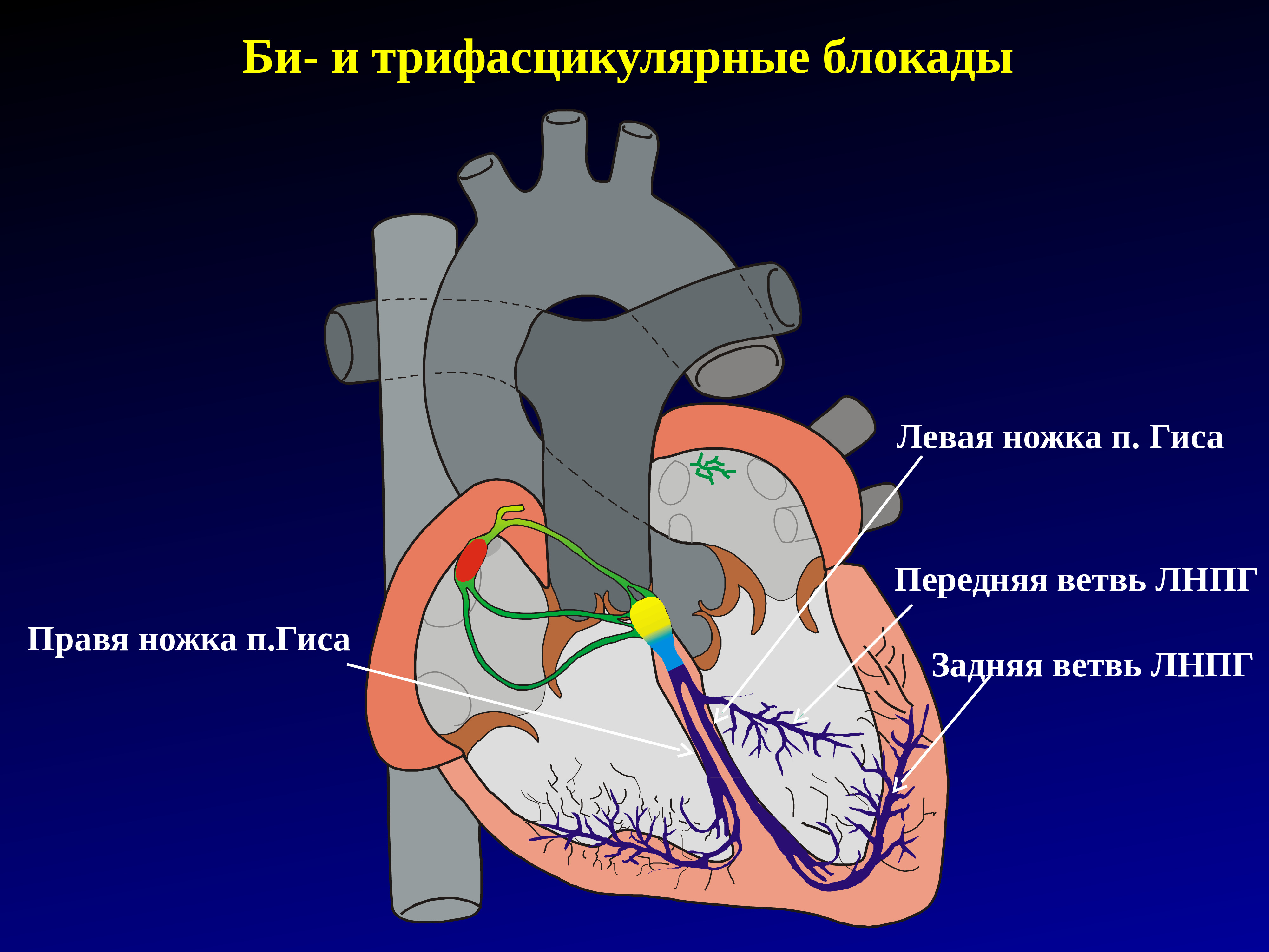 Диагноз ножка гиса