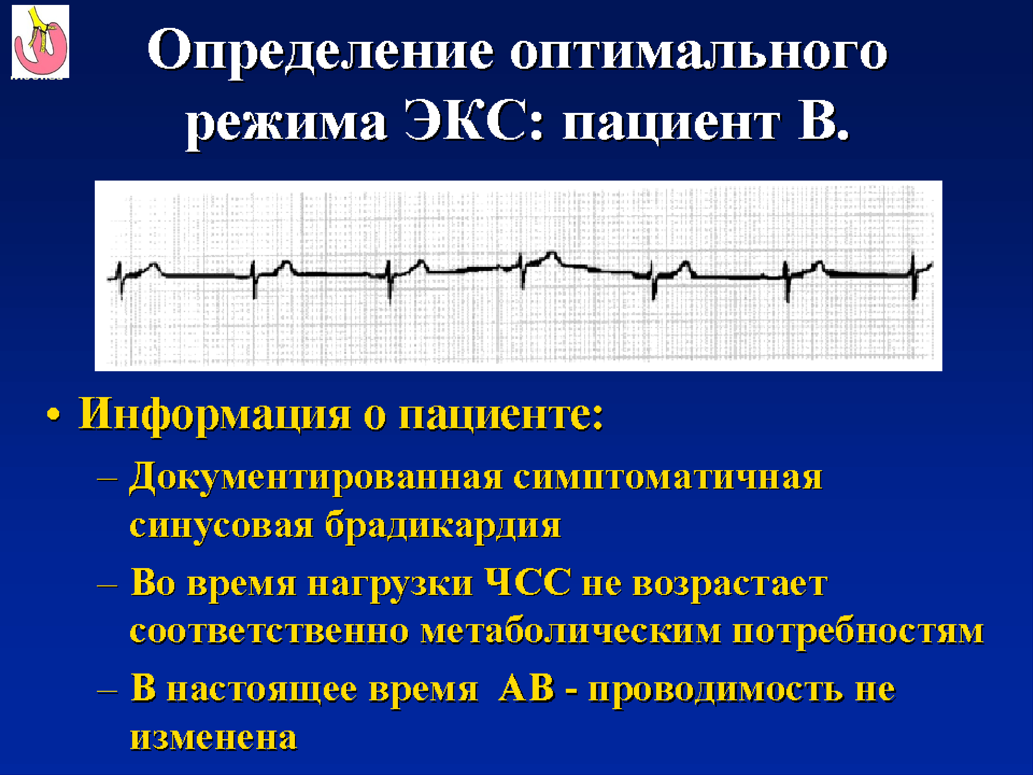 Экс лечение. Осложнение после имплантации экс. Показания к имплантации экс. Имплантация экс формулировка диагноза. Показания к имплантации искусственного водителя ритма.