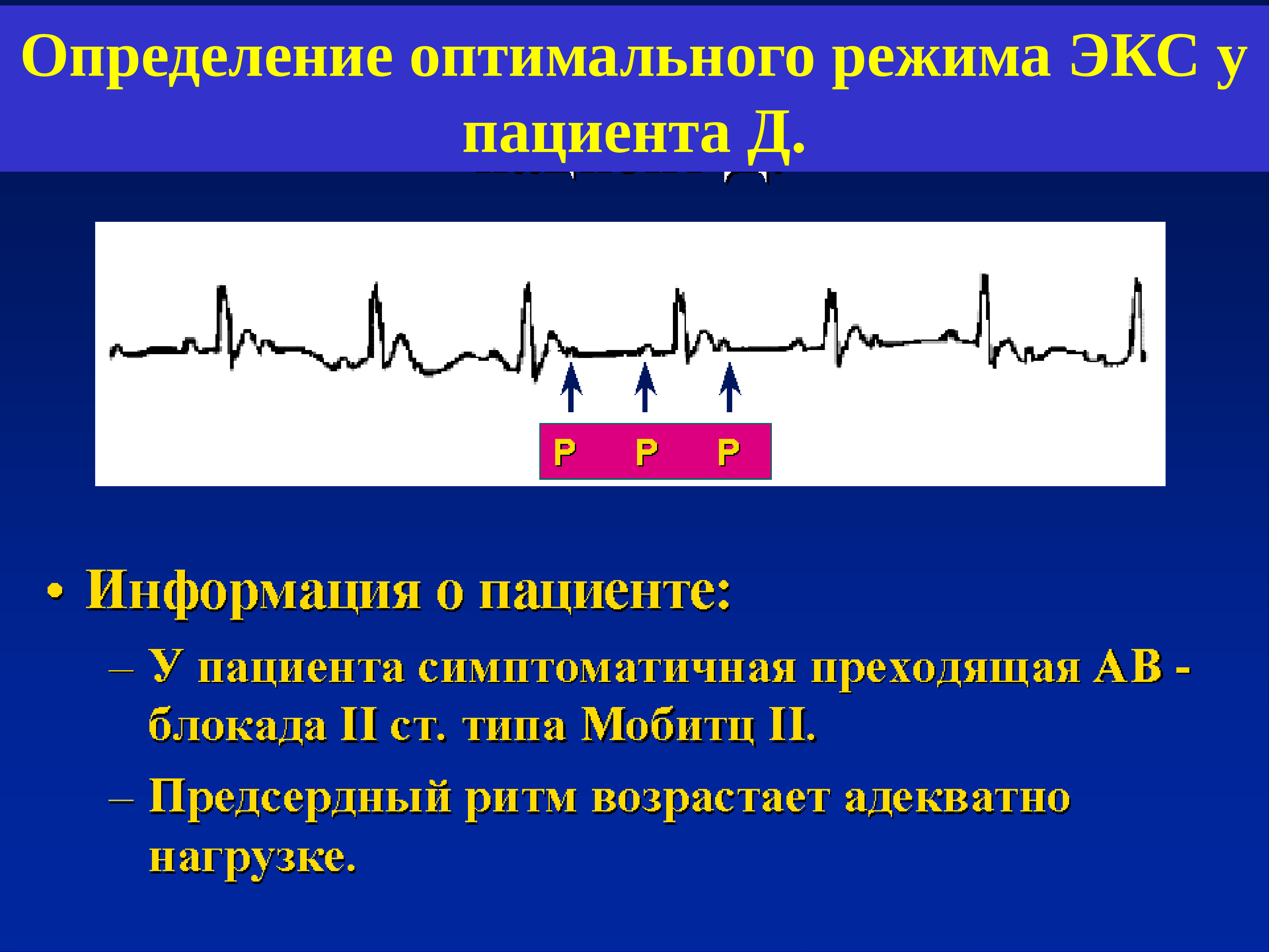 Пациенты с экс. Брадиаритмия презентация. Показания к имплантации экс. Режимы экс. Имплантации экс в кардиологии.