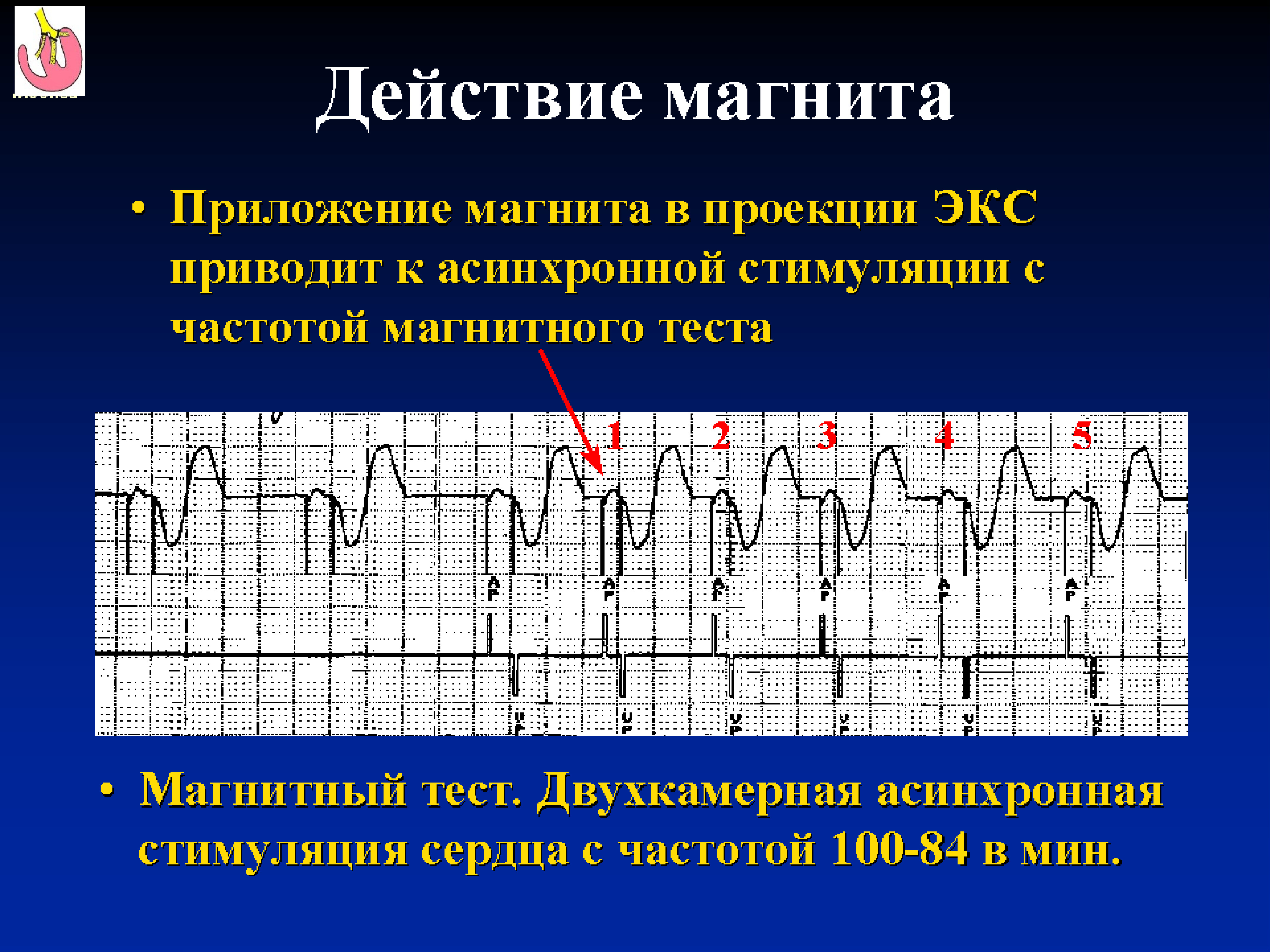 Путем экс. Нарушение работы экс. Магнитный тест экс. ЭКГ магнитный тест экс. Нарушение функции экс.