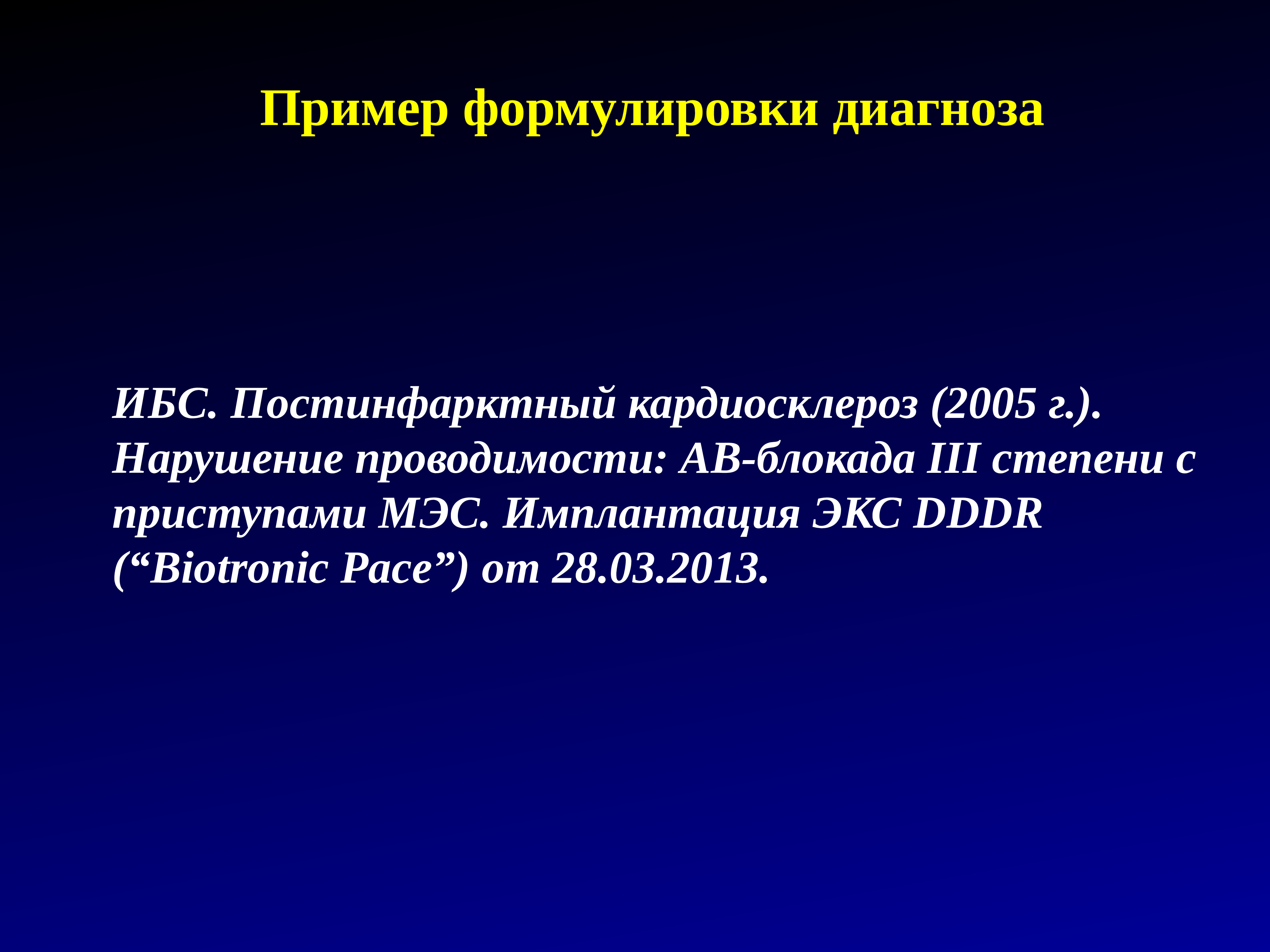 Пример формулировки диагноза. Av блокада формулировка диагноза. ИБС пример формулировки диагноза. Вазоспастическая стенокардия формулировка диагноза. ИБС формулировка диагноза.