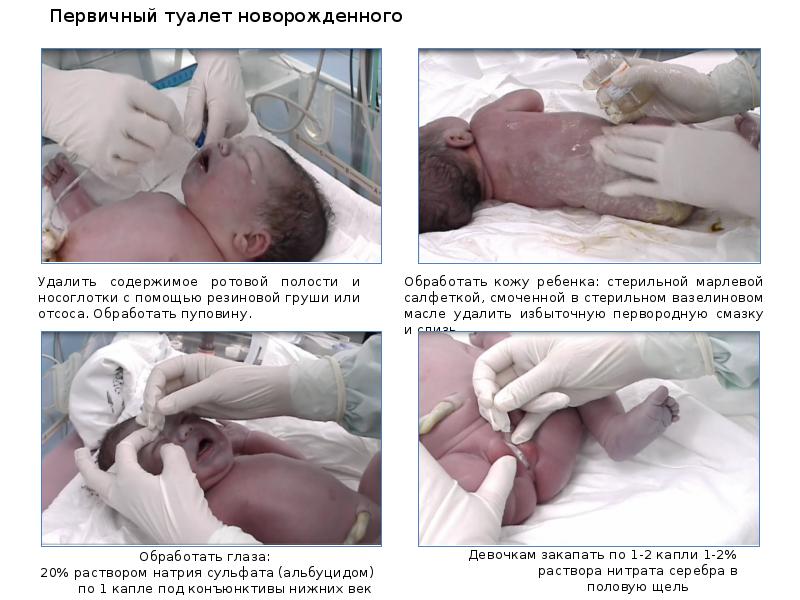 Презентация уход за кожей новорожденного