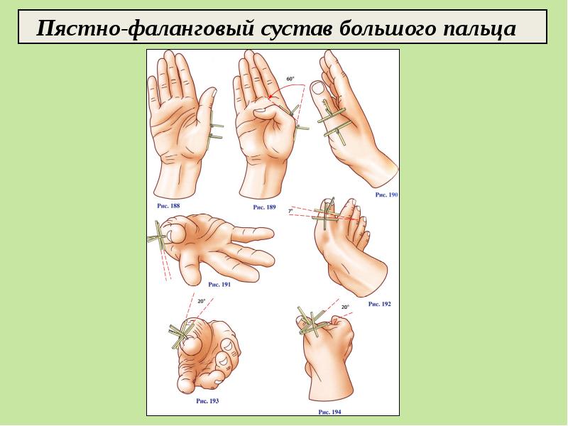 Запястно пястный сустав i пальца. Пястно фаланговый сустав. Пястно фаланговый сустав кисти. Движения в пястно фаланговом суставе. 1 Пястно-фаланговый сустав большого пальца.