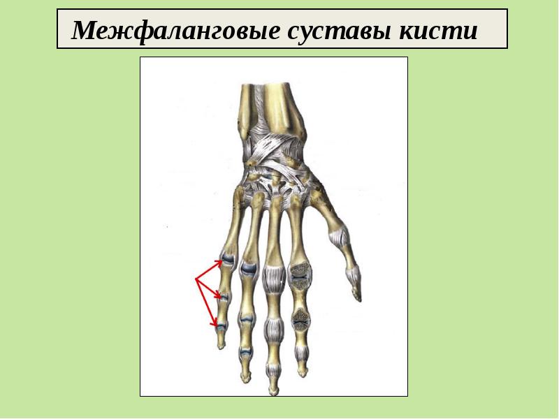 проксимальные межфаланговые суставы кисти. проксимальные межфаланговые суставы кисти. пястно-фаланговый сустав большого пальца стопы. проксимальные межфаланговые суставы кисти. межфаланговые суставы оси движения.