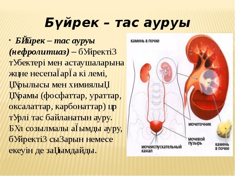 Презентация несеп тас ауруы