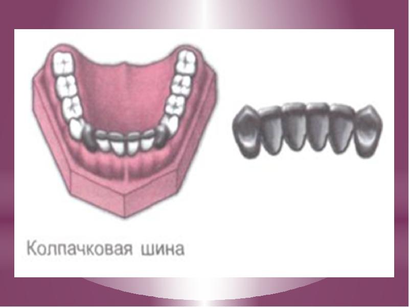 Временные коронки презентация