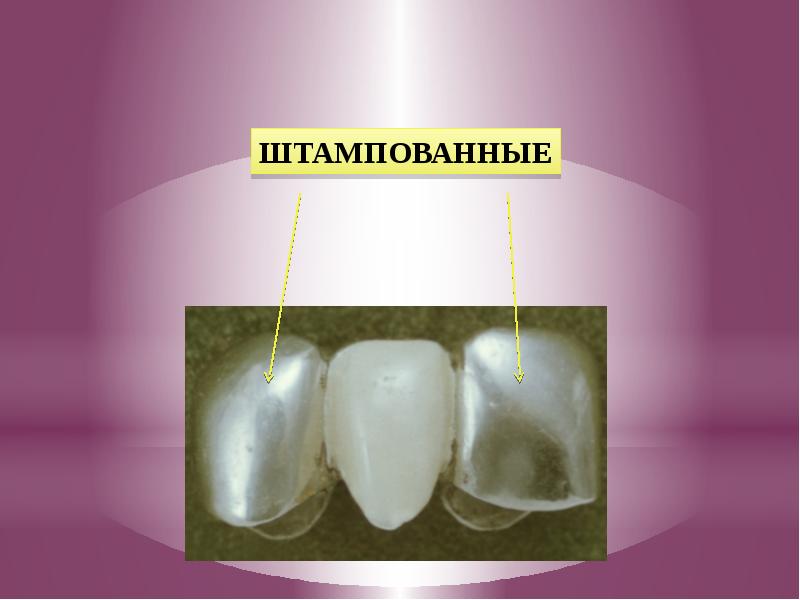 Штампованные коронки презентация