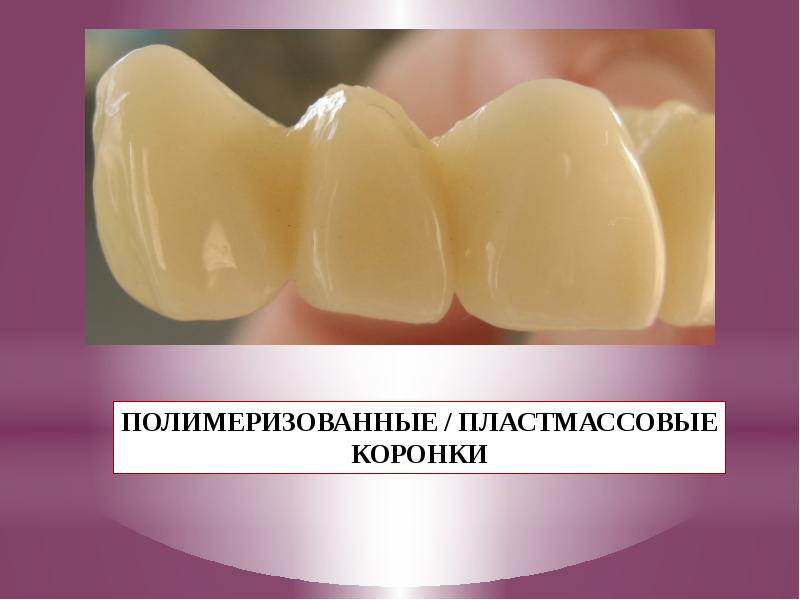 Современные технологии искусственных коронок презентация