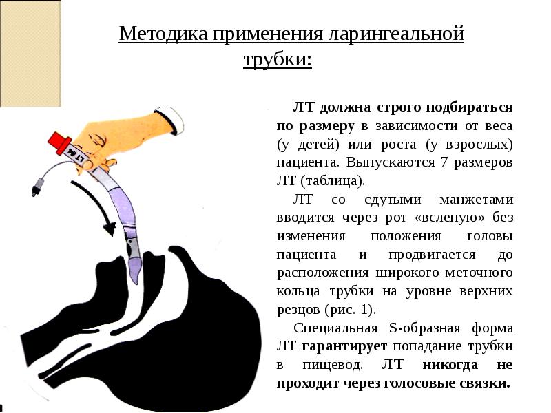 Обеспечение проходимости дыхательных путей презентация