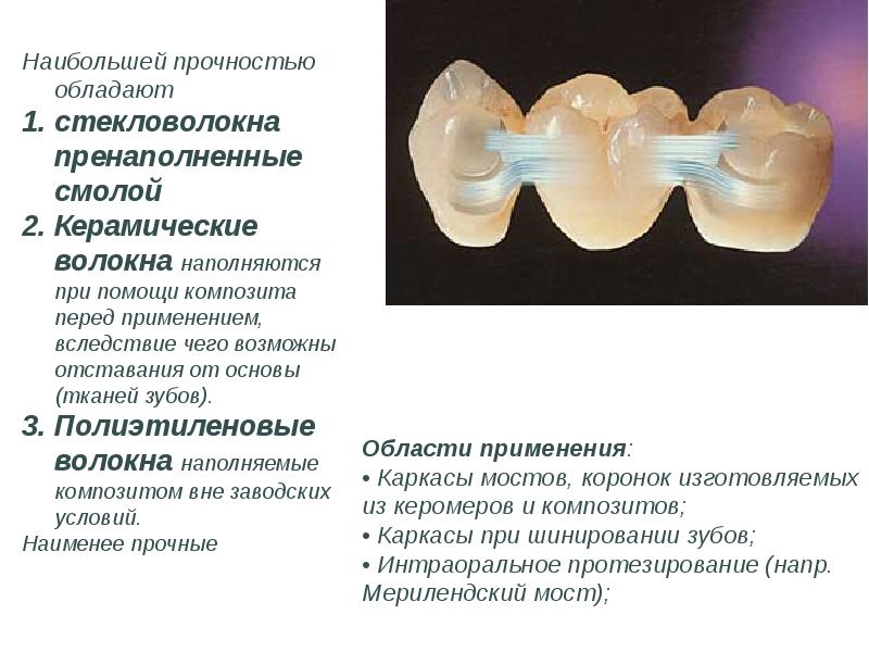 Презентация безметалловая керамика