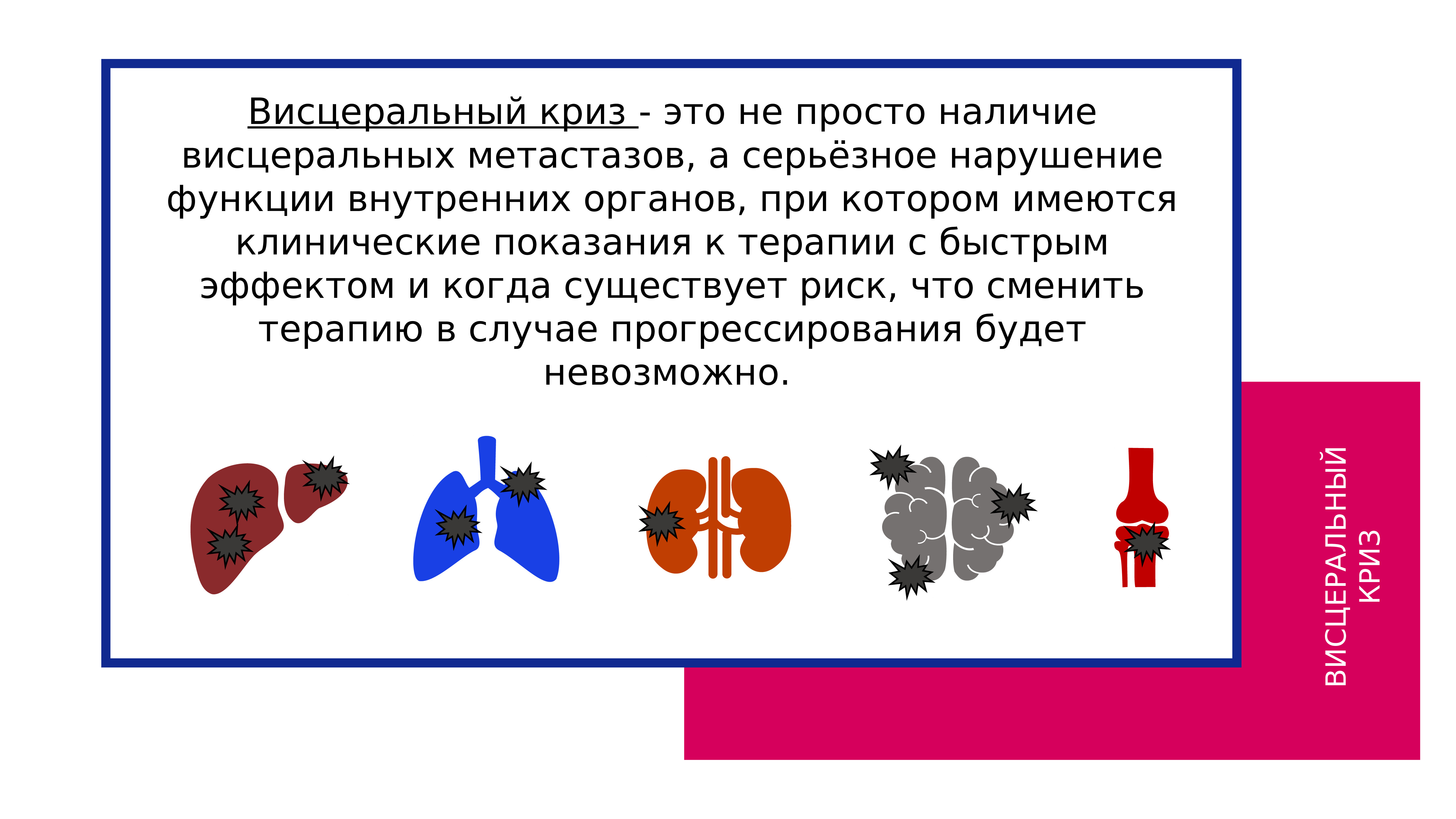 Наличие простой. Висцеральный криз. Висцеральный криз в онкологии. Висцеральный криз в онкологии определение.