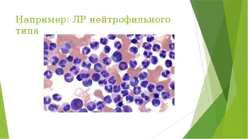 Например: ЛР нейтрофильного типа Например: ЛР нейтрофильного типа