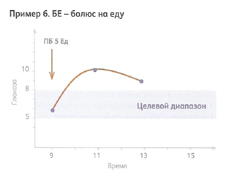 Базис болюсная схема