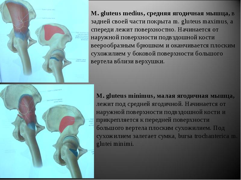 Сухожилие средней ягодичной мышцы. Средняя ягодичная мышца m. gluteus Medius. Энтезопатия ягодичных мышц. Сухожилие средней ягодичной мышцы прикрепление. Энтезопатия средней и малой ягодичных мышц.