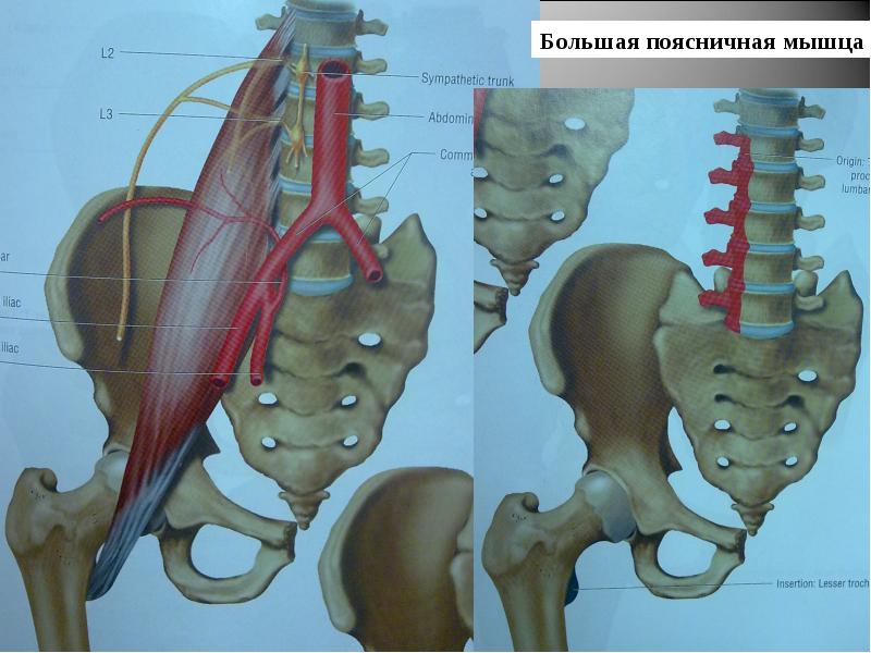 Подвздошная мышца анатомия