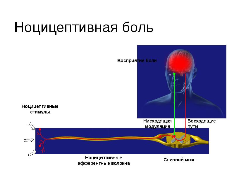 Ноцицептивная сенсорная система презентация