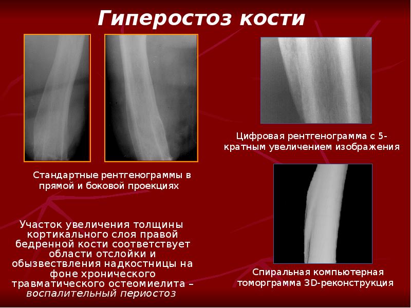 Лучевая анатомия семиотика