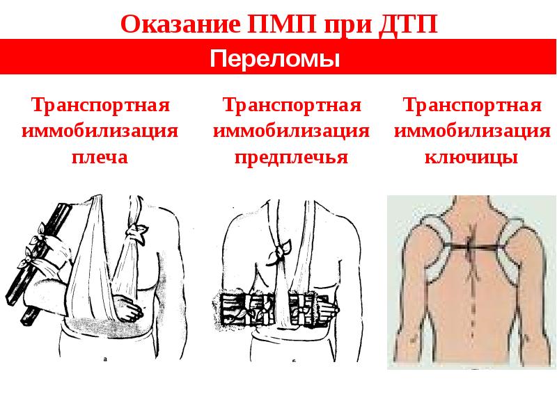 Презентация пмп при дтп