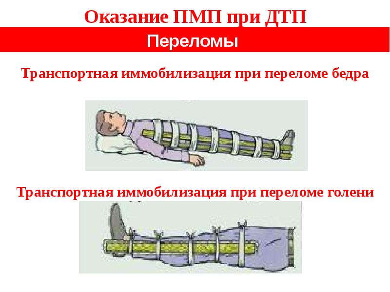 Презентация на тему иммобилизация и транспортировка пострадавших