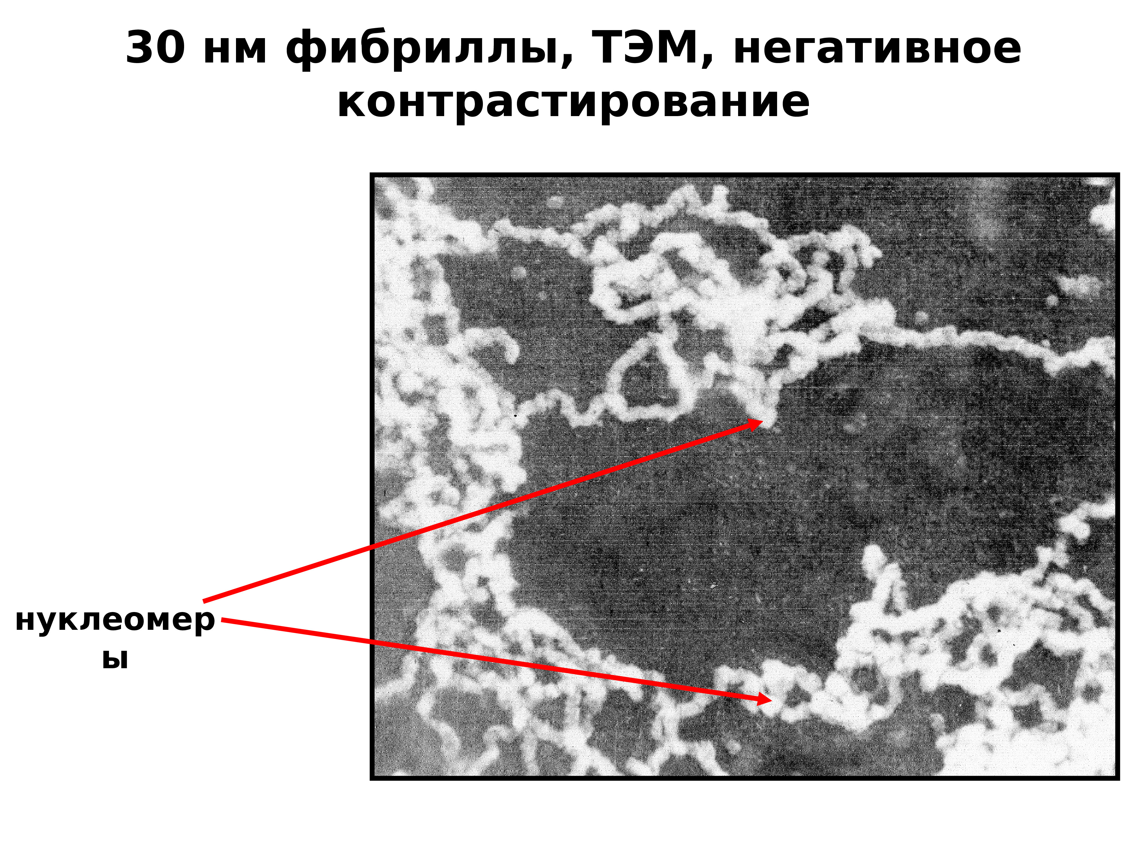 фибриллы это. фибриллы. элементарная хромосомная фибрилла. строение хроматиновой фибриллы. фибриллы это.