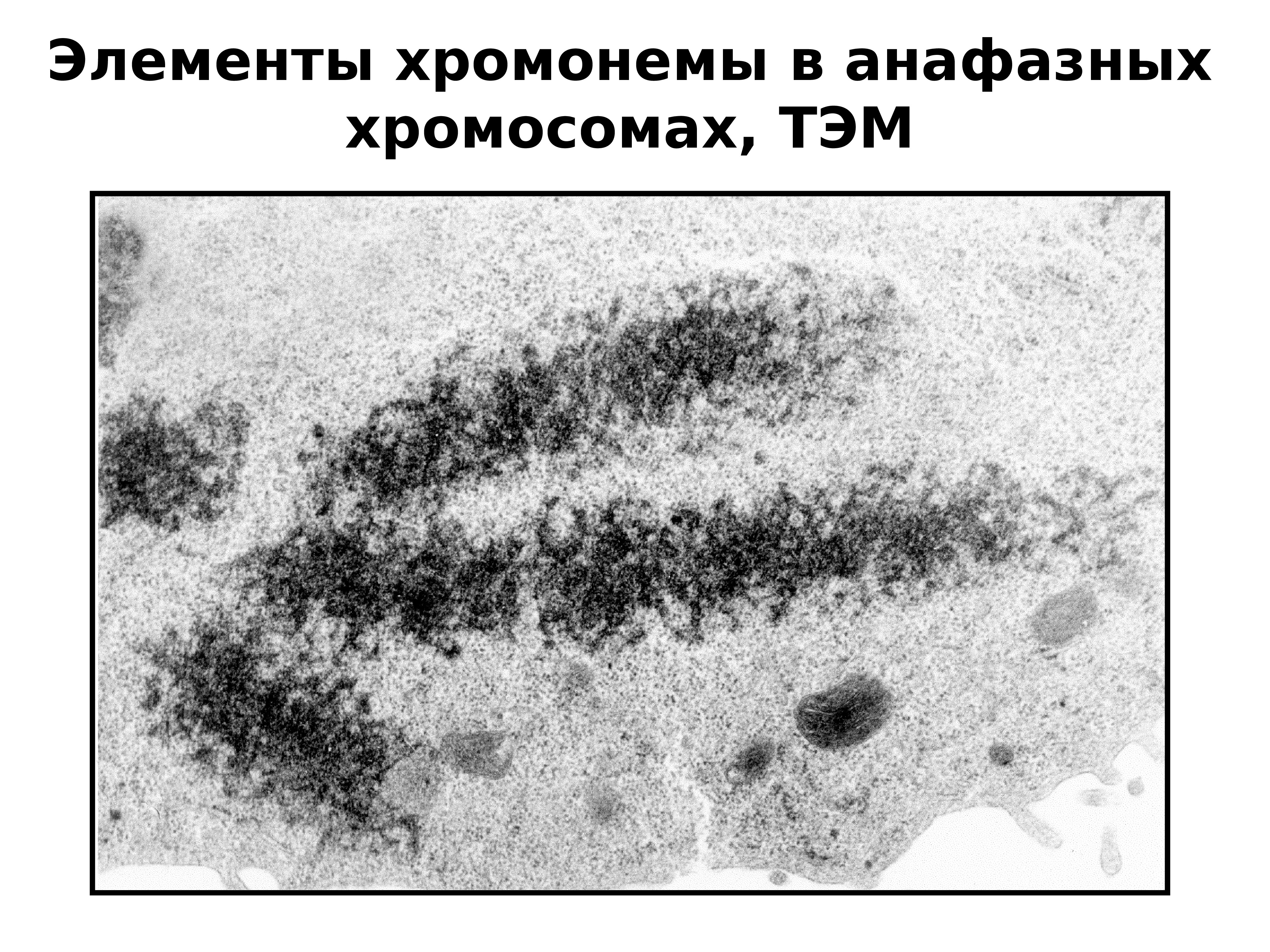 Тельце полового хроматина. Дисперсный хроматин. Иммунопреципитации хроматина. Хроматин и хромосомы. Распыленный хроматин.