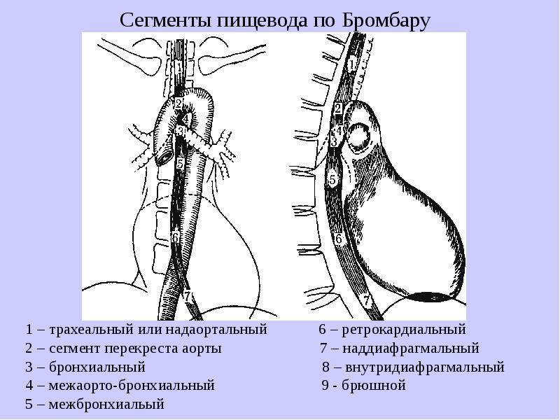 Сегменты пищевода по бромбару схема